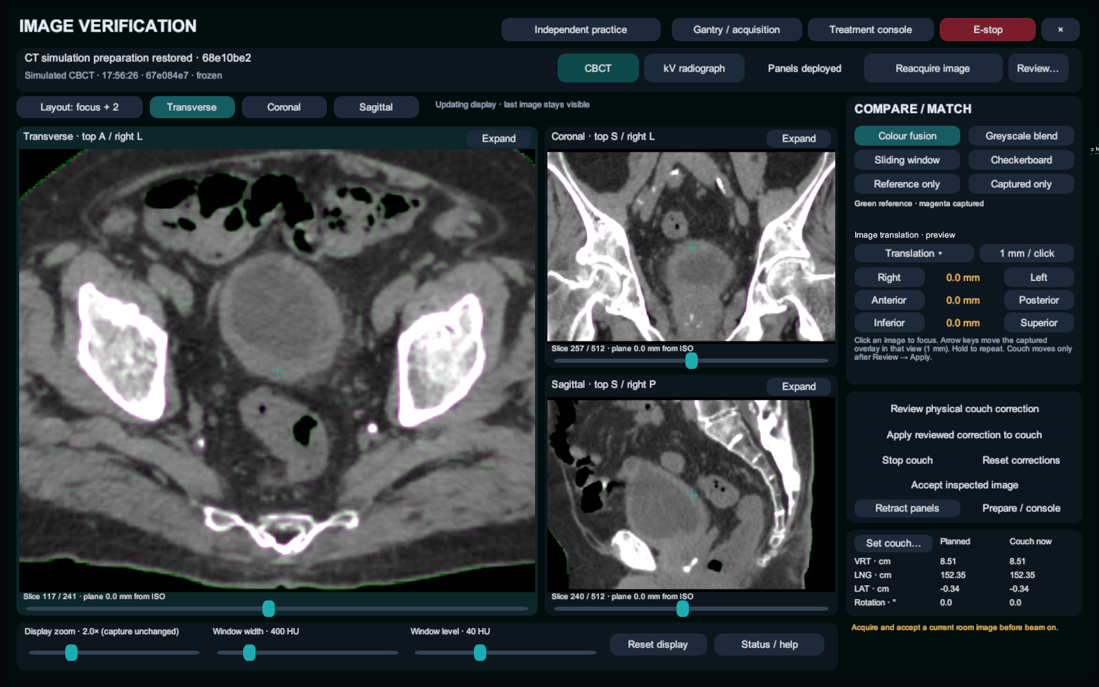 Actual image verification workspace with transverse, coronal and sagittal CT views and matching controls